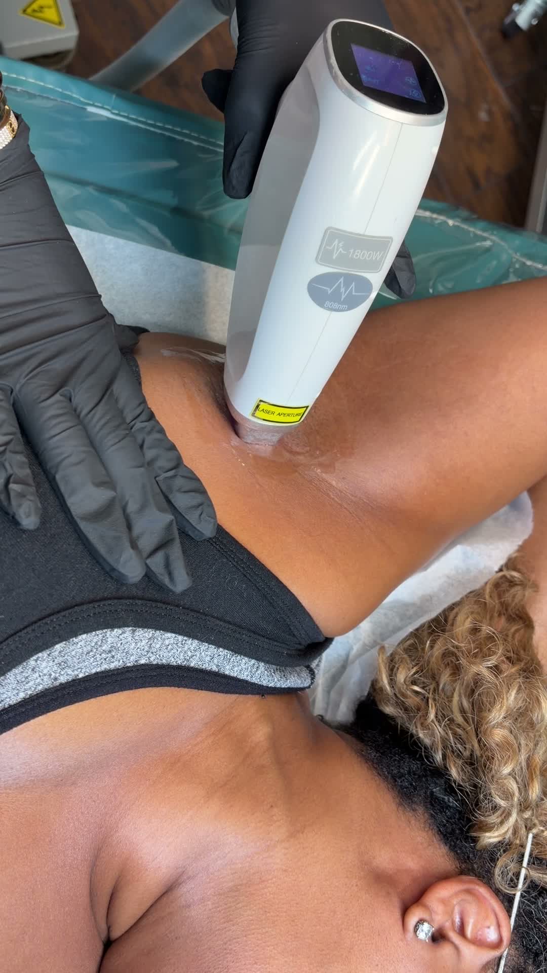 A real laser hair removal session on melanated skin at I Am Beautiful by Mia, Atlanta